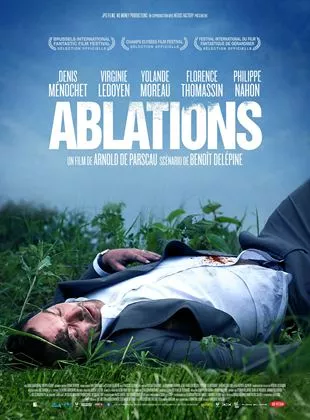 Affiche du film Ablations
